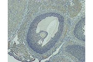 Expression of GnRHR in rat ovary - Immunohistochemical staining of rat ovary paraffin-embedded sections using Anti-GnRH Receptor (extracellular) Antibody (ABIN7043262 and ABIN7044416). (GNRHR Antikörper  (Extracellular))