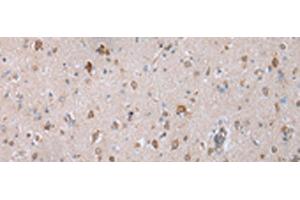 Immunohistochemistry of paraffin-embedded Human brain tissue using COX7C Polyclonal Antibody at dilution of 1:40(x200) (COX7C Antikörper)