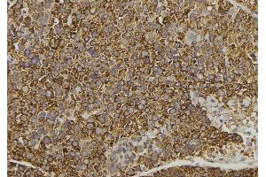 Immunohistochemistry (IHC) image for anti-Wingless-Type MMTV Integration Site Family, Member 16 (WNT16) (C-Term) antibody (ABIN6266038)
