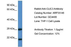 WB Suggested Anti-CLIC3 Antibody   Titration: 1. (CLIC3 Antikörper  (N-Term))