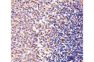 Immunohistochemical analysis of paraffin-embedded mouse spleen section using Cyclin B1 antibody.