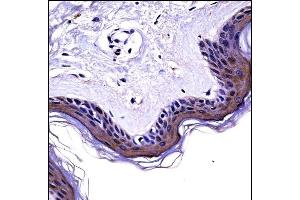 NCK2 Antibody (N-term) ((ABIN658028 and ABIN2846966))immunohistochemistry analysis in formalin fixed and paraffin embedded human skin tissue followed by peroxidase conjugation of the secondary antibody and DAB staining. (NCK2 Antikörper  (N-Term))