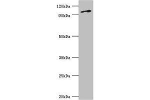 Western blot All lanes: DNA replication licensing factor MCM6 antibody at 3 μg/mL + Jurkat whole cell lysate Secondary Goat polyclonal to rabbit IgG at 1/10000 dilution Predicted band size: 93 kDa Observed band size: 93 kDa