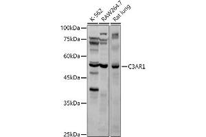 Western blot analysis of extracts of various cell lines, using C3 antibody (ABIN6131229, ABIN6137771, ABIN6137772 and ABIN6221976) at 1:1000 dilution. (C3AR1 Antikörper  (AA 161-337))