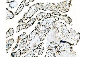 IHC analysis of GRHL2 using anti-GRHL2 antibody (ABIN7599505).
