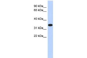 WB Suggested Anti-ACTRT1 Antibody Titration: 0.