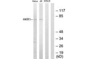 Western Blotting (WB) image for anti-HKR1, GLI-Kruppel Zinc Finger Family Member (HKR1) (AA 141-190) antibody (ABIN2889387) (HKR1 Antikörper  (AA 141-190))