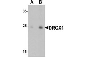 Western blot analysis of DRGX in rat liver tissue lysate with DRGX Antibody  at (A) 1 and (B) 2 ug/mL.