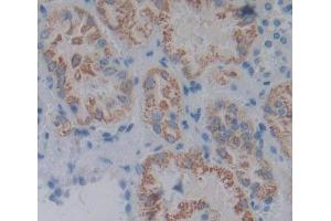 Used in DAB staining on fromalin fixed paraffin- embedded kidney tissue (ACP6 Antikörper  (AA 1-428))