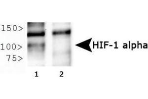 Image no. 10 for anti-Hypoxia Inducible Factor 1, alpha Subunit (Basic Helix-Loop-Helix Transcription Factor) (HIF1A) (AA 329-530) antibody (ABIN363210) (HIF1A Antikörper  (AA 329-530))