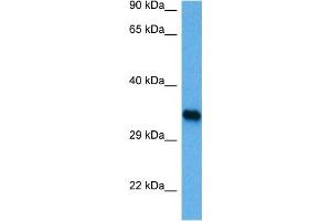 Host:  Rabbit  Target Name:  IRF1  Sample Tissue:  Mouse Brain  Antibody Dilution:  1ug/ml (IRF1 Antikörper  (C-Term))