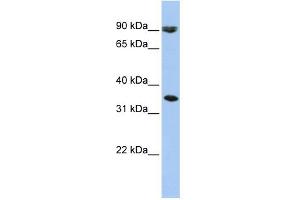 WB Suggested Anti-SLC10A7 Antibody Titration:  0.