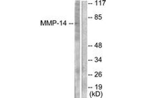Western blot analysis of extracts from NIH-3T3 cells, using MMP-14 Antibody. (MMP14 Antikörper  (AA 471-520))