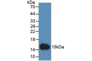 Detection of Recombinant Cys-c, Human using Monoclonal Antibody to Cystatin C (Cys-C) (CST3 Antikörper  (AA 27-146))