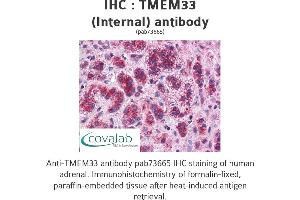 Image no. 1 for anti-Transmembrane Protein 33 (TMEM33) (Internal Region) antibody (ABIN1740155) (TMEM33 Antikörper  (Internal Region))