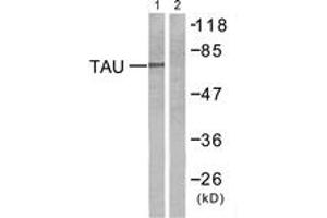 Western blot analysis of extracts from mouse brain cells, using Tau (Ab-212) Antibody. (tau Antikörper  (AA 496-545))