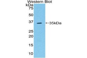 Western Blotting (WB) image for anti-Raftlin, Lipid Raft Linker 1 (RFTN1) (AA 207-451) antibody (ABIN1860396)
