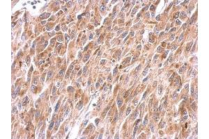 Immunohistochemistry (IHC) image for anti-NADH Dehydrogenase (Ubiquinone) Fe-S Protein 8, 23kDa (NADH-Coenzyme Q Reductase) (NDUFS8) (Center) antibody (ABIN2856948)