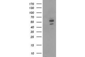 Image no. 1 for anti-Carnosine Dipeptidase 1 (Metallopeptidase M20 Family) (CNDP1) antibody (ABIN1497547) (CNDP1 Antikörper)