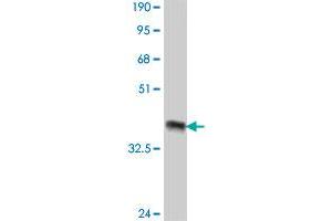 Western Blot detection against Immunogen (37 KDa) . (ROBO1 Antikörper  (AA 491-589))