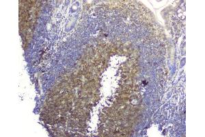 IHC analysis of SQSTM1 using anti-SQSTM1 antibody (ABIN3043937). (SQSTM1 Antikörper  (N-Term))