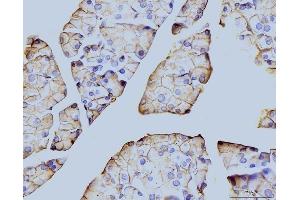 IHC analysis of Annexin VI using anti-Annexin VI antibody (ABIN7601597).