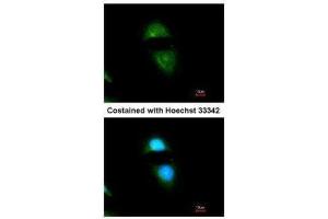 ICC/IF Image Immunofluorescence analysis of methanol-fixed HeLa, using Cytochrome P450 Reductase, antibody at 1:200 dilution. (POR Antikörper  (N-Term))