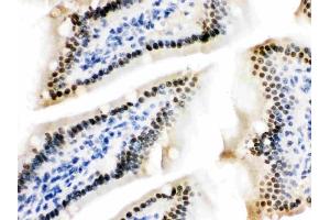 IHC analysis of ZBTB7A using anti-ZBTB7A antibody (ABIN3044569).