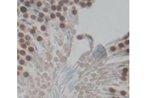 IHC-P analysis of Kidney tissue, with DAB staining. (FOXM1 Antikörper  (AA 209-460))