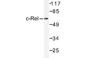Image no. 1 for anti-REL proto-oncogene (c-Rel) antibody (ABIN271805) (c-Rel Antikörper)