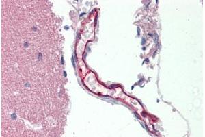 Immunohistochemistry (IHC) image for anti-ATP-Binding Cassette, Sub-Family B (MDR/TAP), Member 1 (ABCB1) (AA 995-1280) antibody (ABIN1804644)