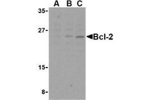 Western blot analysis of Bcl-2 in A-20 cell lysates with AP30129PU-N Bcl-2 antibody at (A) 1, (B) 2, and (C) 4 μg/ml. (Bcl-2 Antikörper  (Intermediate Domain))