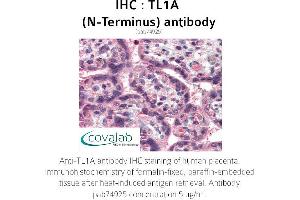 Image no. 1 for anti-Tumor Necrosis Factor (Ligand) Superfamily, Member 15 (TNFSF15) antibody (ABIN1740101) (TNFSF15 Antikörper)