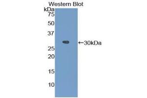 Western blot analysis of the recombinant protein. (FGA Antikörper  (AA 34-255))