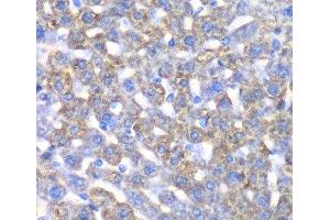 Immunohistochemistry of paraffin-embedded Mouse liver using CCBL1 Polyclonal Antibody at dilution of 1:100 (40x lens). (CCBL1 Antikörper)