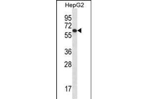 TBC1D22A Antibody (C-term) (ABIN656780 and ABIN2845998) western blot analysis in HepG2 cell line lysates (35 μg/lane). (TBC1D22A Antikörper  (C-Term))