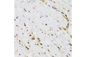 Immunohistochemistry of paraffin-embedded human stomach using RAD50 Antibody. (RAD50 Antikörper)