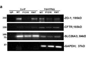Western Blotting (WB) image for anti-Tight Junction Protein 1 (TJP1) (N-Term) antibody (ABIN2856624)