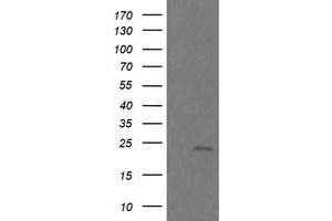 Image no. 3 for anti-RAB21, Member RAS Oncogene Family (RAB21) antibody (ABIN1500545) (RAB21 Antikörper)