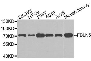Western blot analysis of extracts of various cell lines, using FBLN5 antibody. (Fibulin 5 Antikörper  (AA 199-448))