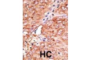 Immunohistochemistry (IHC) image for anti-Chemokine Binding Protein 2 (CCBP2) antibody (ABIN3001324) (CCBP2 Antikörper)