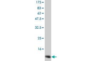 Western Blot detection against Immunogen (14 KDa) . (GM-CSF Antikörper)