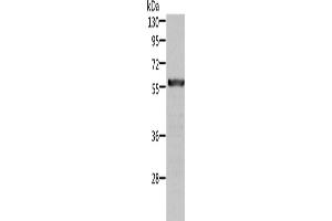 Western Blotting (WB) image for anti-Aldehyde Dehydrogenase 6 Family, Member A1 (ALDH6A1) antibody (ABIN2422525) (ALDH6A1 Antikörper)