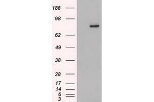 Western Blotting (WB) image for anti-Signal Transducer and Activator of Transcription 4 (STAT4) (AA 633-652) antibody (ABIN1491621) (STAT4 Antikörper  (AA 633-652))
