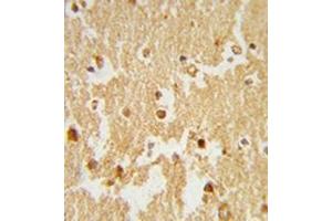 Formalin-fixed and paraffin-embedded human brain tissue reacted with ESRRB Antibody , which was peroxidase-conjugated to the secondary antibody, followed by DAB staining. (ESRRB Antikörper  (Middle Region))
