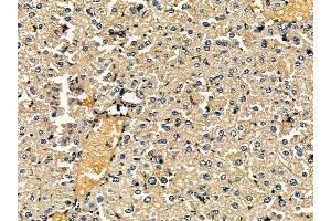 ABIN7095442 and ABIN7099499 at 1/100 staining mouse liver tissue by IHC-P. (HMGCS2 Antikörper)