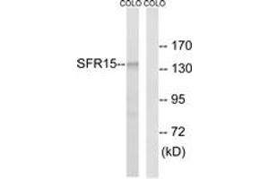 Western blot analysis of extracts from COLO cells, using SFRS15 Antibody. (SCAF4 Antikörper  (AA 601-650))