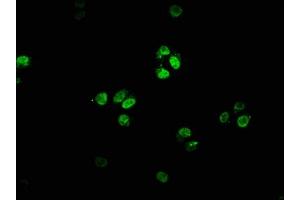 Immunofluorescence staining of HepG2 cells with ABIN7153076 at 1:66, counter-stained with DAPI. (FOXN4 Antikörper  (AA 89-194))