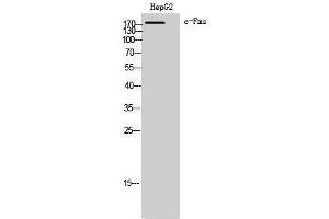 Western Blotting (WB) image for anti-Colony Stimulating Factor 1 Receptor (CSF1R) (Ser275) antibody (ABIN3183879) (CSF1R Antikörper  (Ser275))