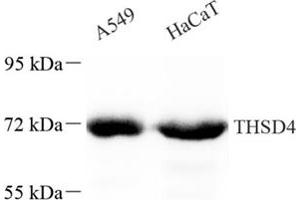 Western blot analysis of THSD4 (ABIN7075894),at dilution of 1: 200 (Thrombospondin, Type I, Domain Containing 4 (THSD4) Antikörper)
